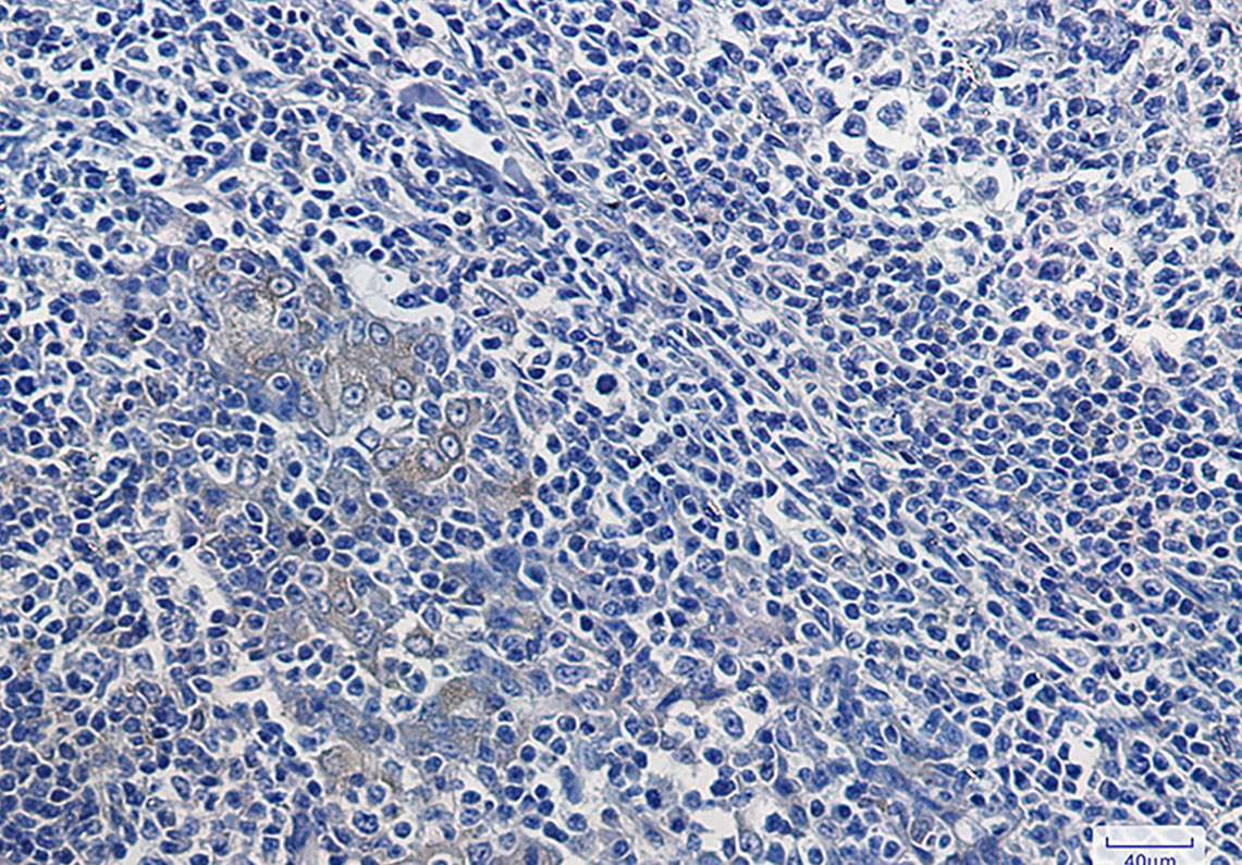 IKB alpha Rabbit mAb