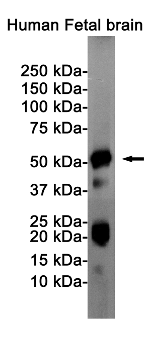 Phospho-Tau (Ser404) Rabbit mAb