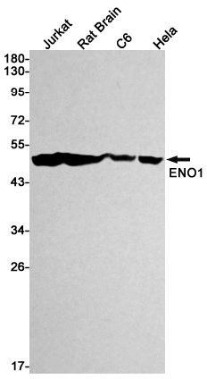 ENO1 Rabbit mAb