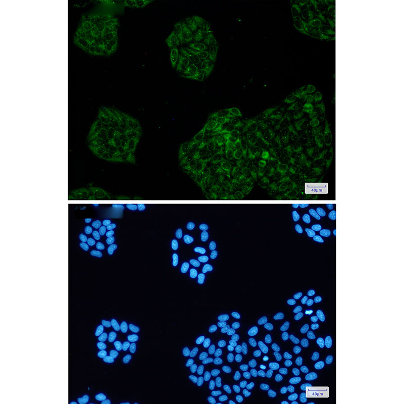 Amyloid Precursor Protein Rabbit mAb