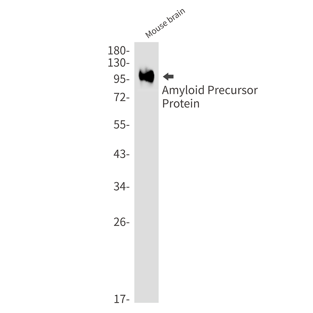 Amyloid Precursor Protein Rabbit mAb