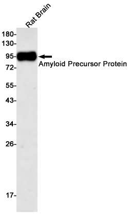 Amyloid Precursor Protein Rabbit mAb