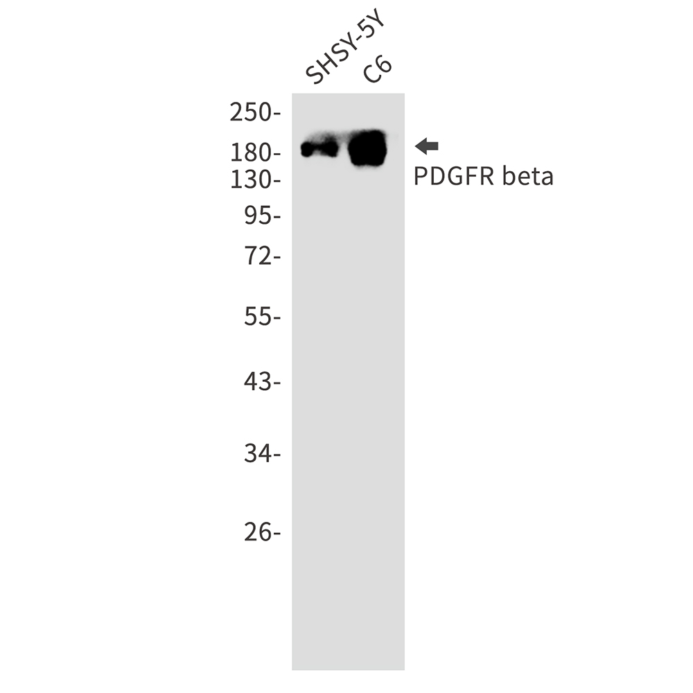 PDGFR beta Rabbit mAb