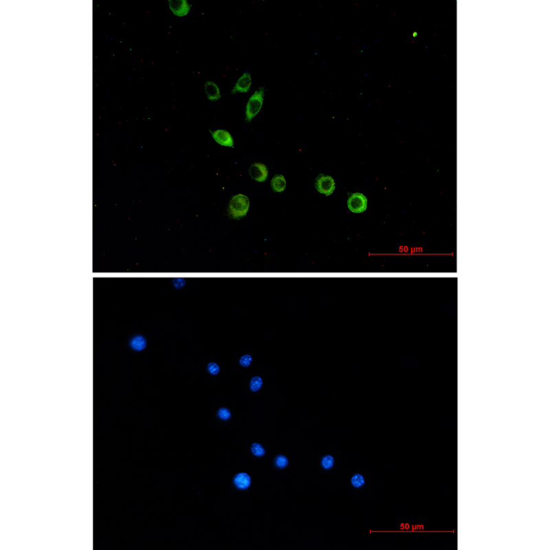 Toll-Like Receptor 2 Rabbit mAb