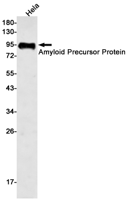 Amyloid Precursor Protein Rabbit mAb