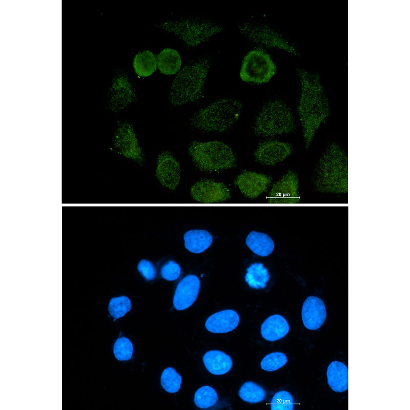 ATF2 Rabbit mAb