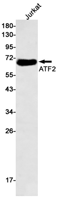 ATF2 Rabbit mAb