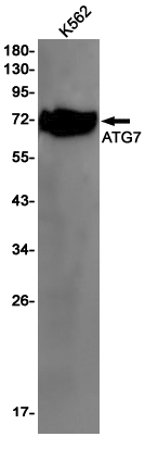 ATG7 Rabbit mAb