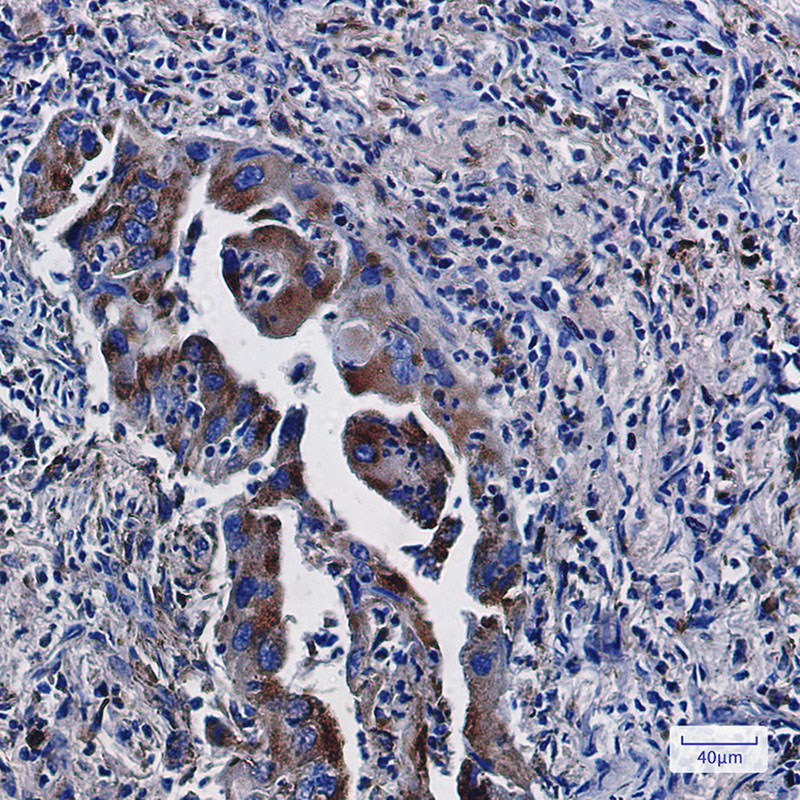 LAMP2 Rabbit mAb