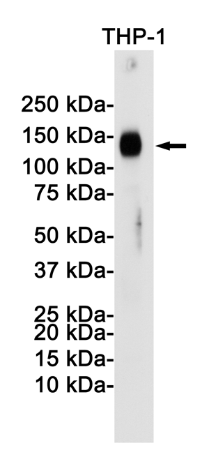 LAMP2 Rabbit mAb