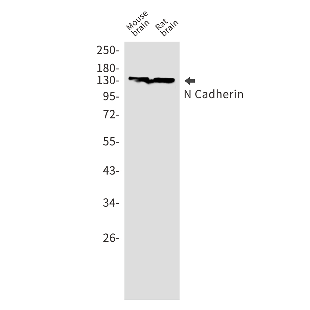 N Cadherin Rabbit mAb