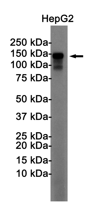 N Cadherin Rabbit mAb