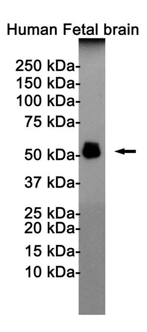 Phospho-Tau (Thr181) Rabbit mAb