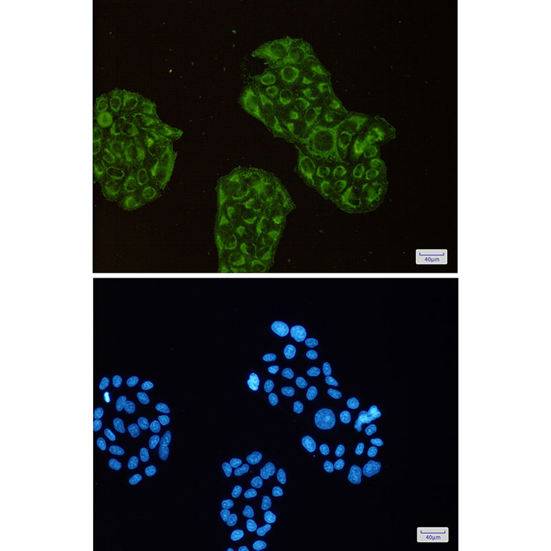 ACADM Rabbit mAb