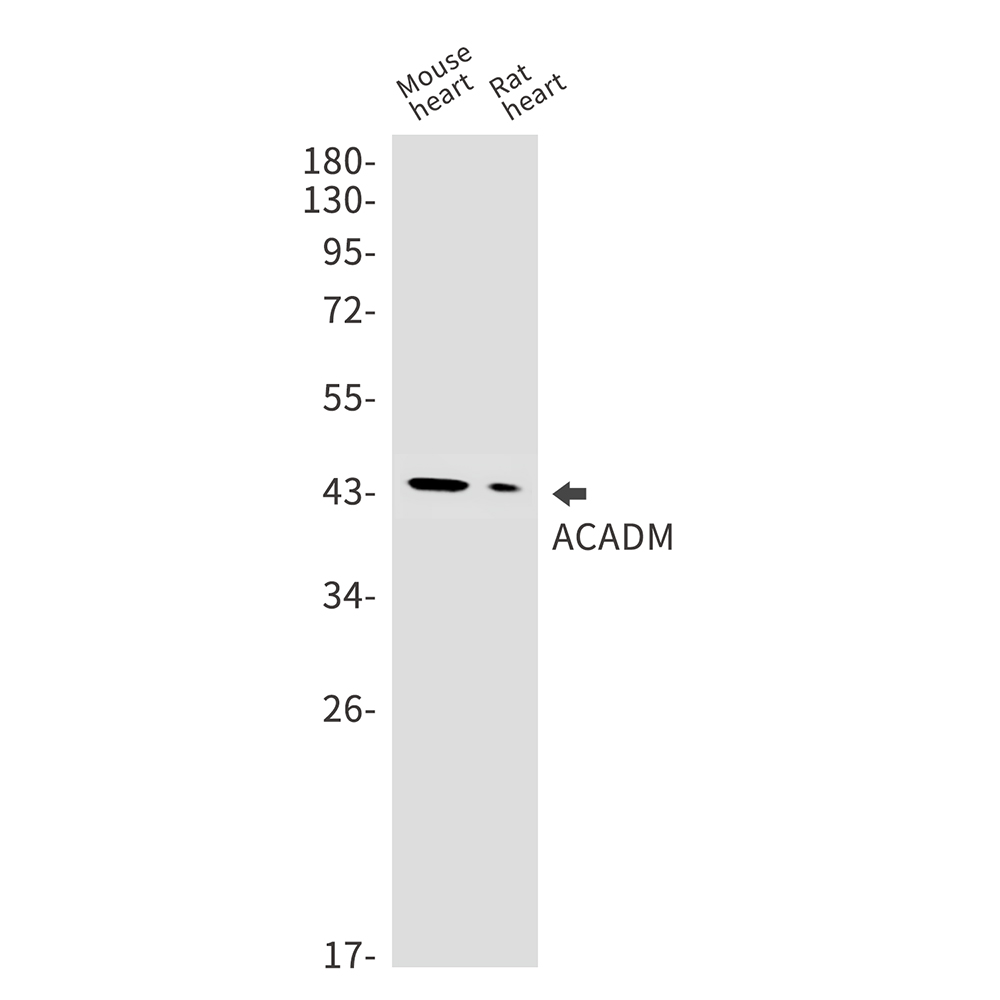 ACADM Rabbit mAb