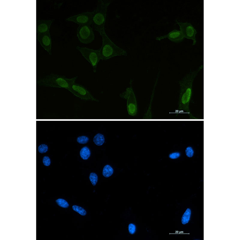 Acetyl-p53 (Lys370) Rabbit mAb