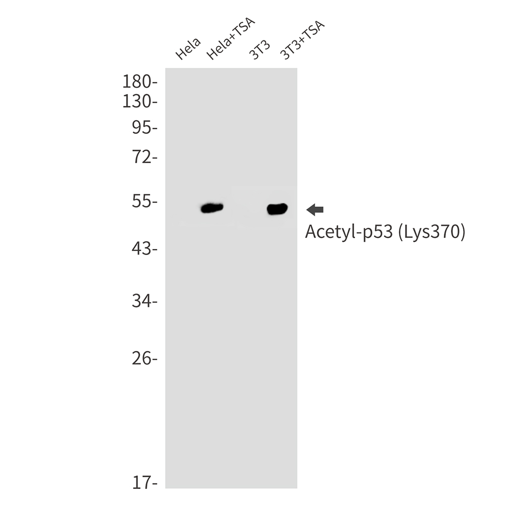 Acetyl-p53 (Lys370) Rabbit mAb