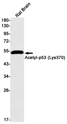 Acetyl-p53 (Lys370) Rabbit mAb