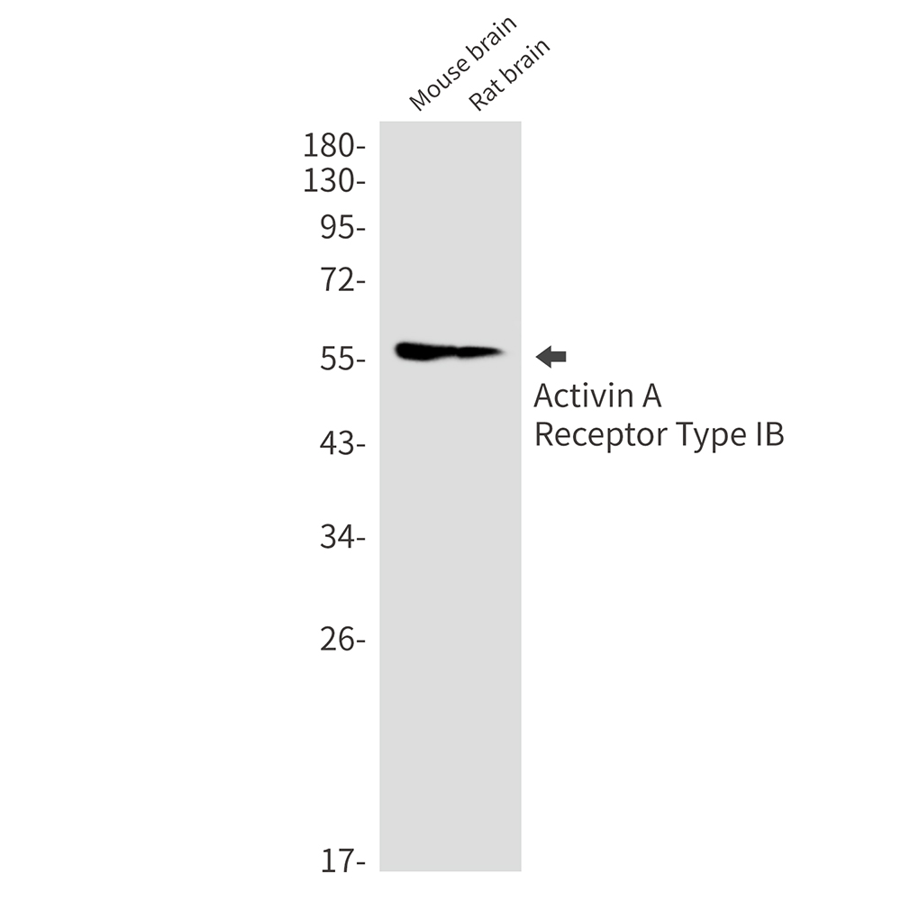 Activin A Receptor Type IB Rabbit mAb