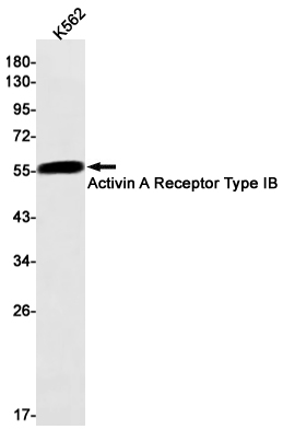 Activin A Receptor Type IB Rabbit mAb