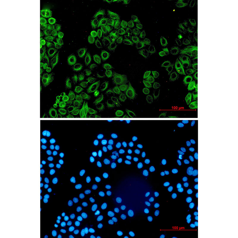 Activin A Receptor Type IB Rabbit mAb