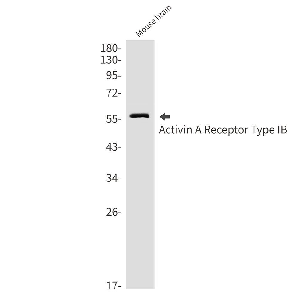 Activin A Receptor Type IB Rabbit mAb