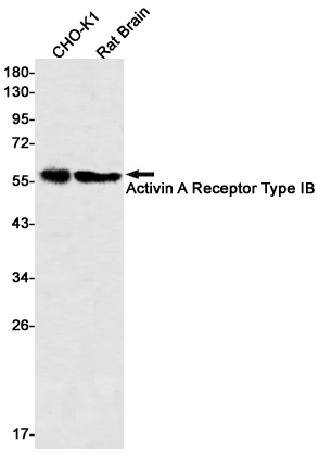 Activin A Receptor Type IB Rabbit mAb