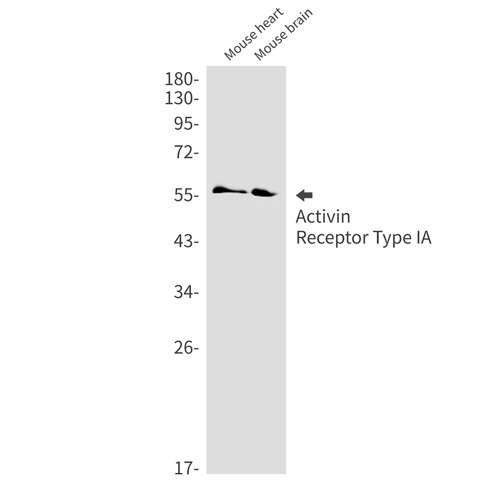 Activin Receptor Type IA Rabbit mAb