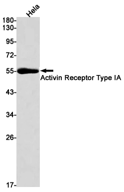 Activin Receptor Type IA Rabbit mAb