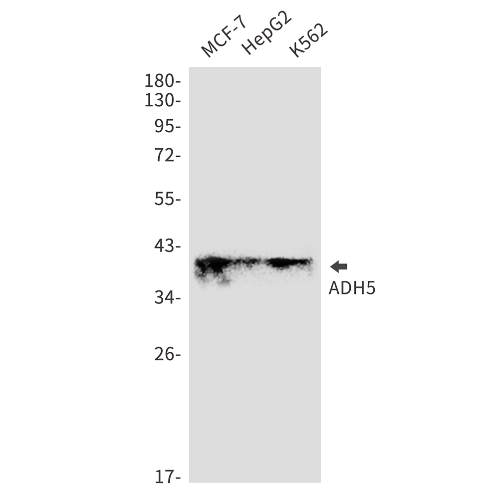 ADH5 Rabbit mAb