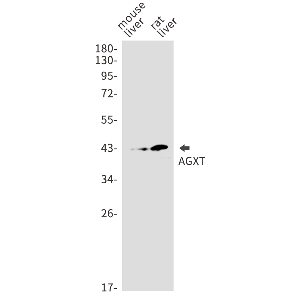 AGXT Rabbit mAb