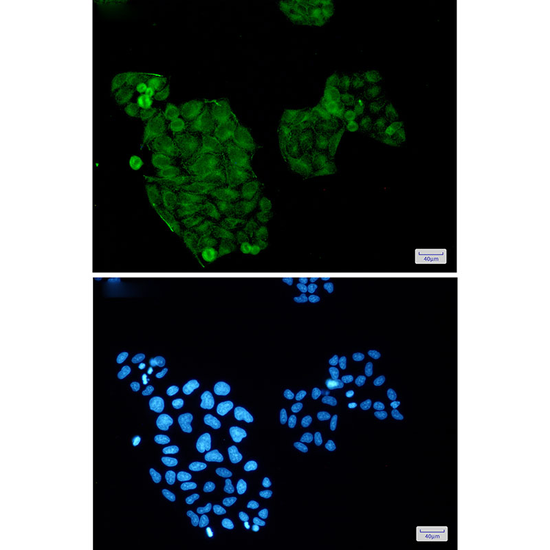 AKT Rabbit mAb