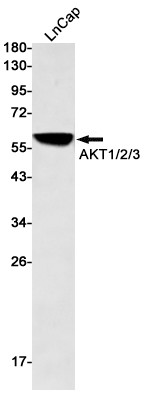 AKT Rabbit mAb