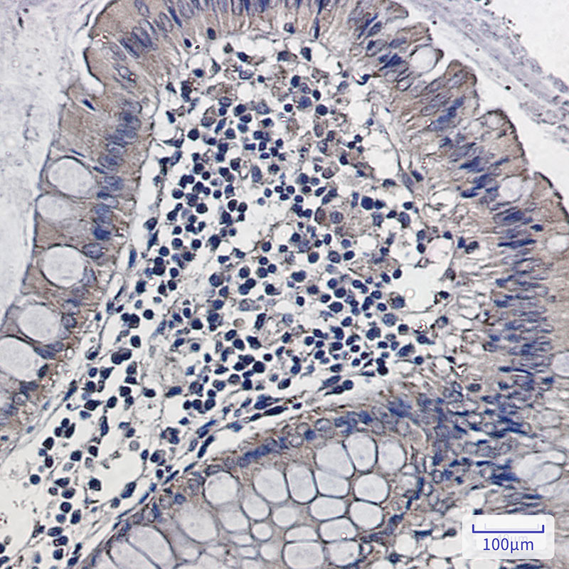 ALDH2 Rabbit mAb