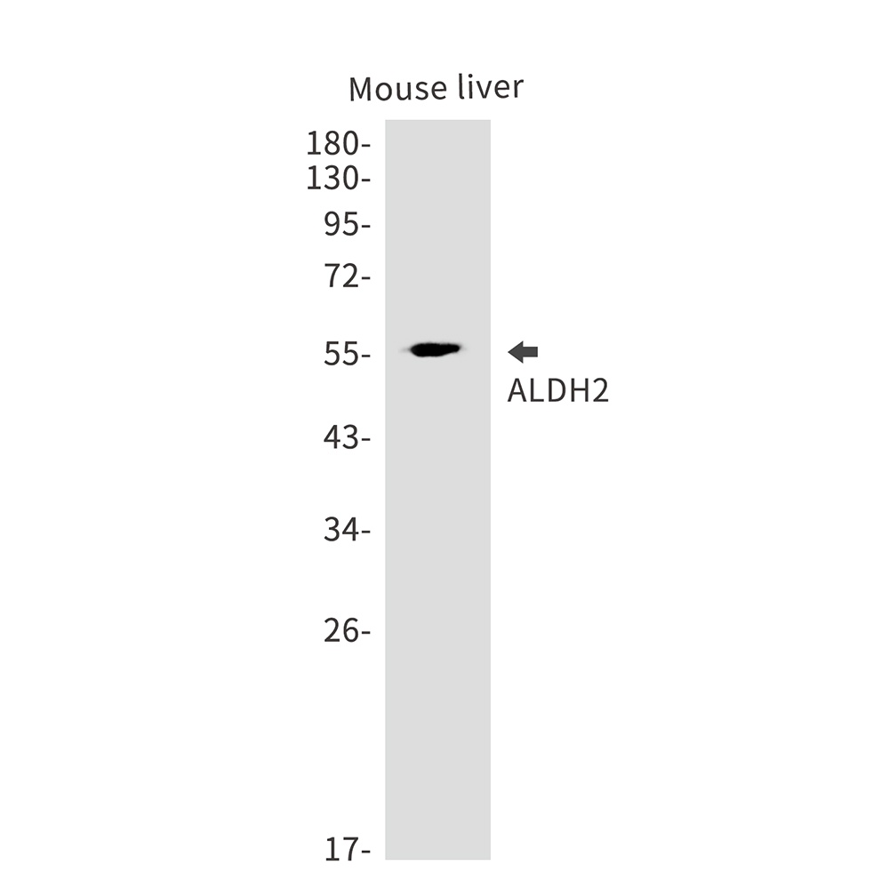 ALDH2 Rabbit mAb