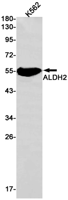 ALDH2 Rabbit mAb