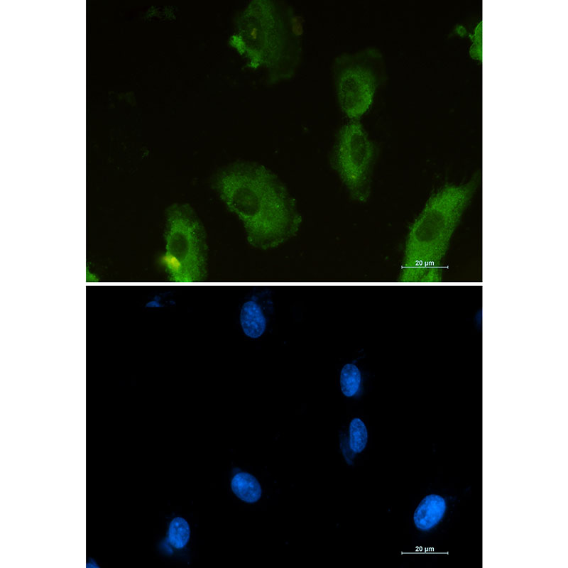 ALDOA Rabbit mAb