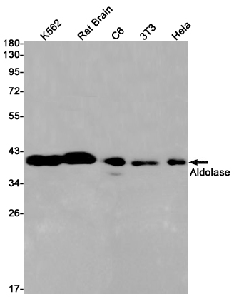 ALDOA Rabbit mAb