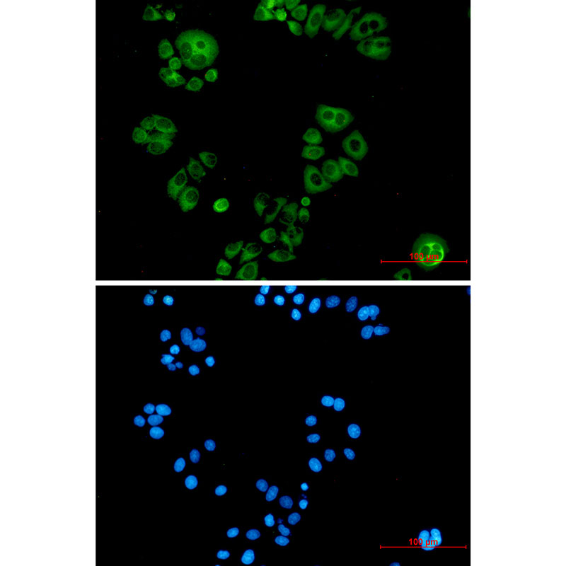 Alkaline Phosphatase Rabbit mAb