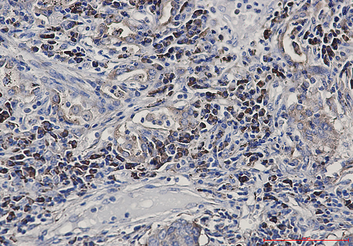 Alkaline Phosphatase Rabbit mAb