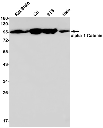 CTNNA1 Rabbit mAb