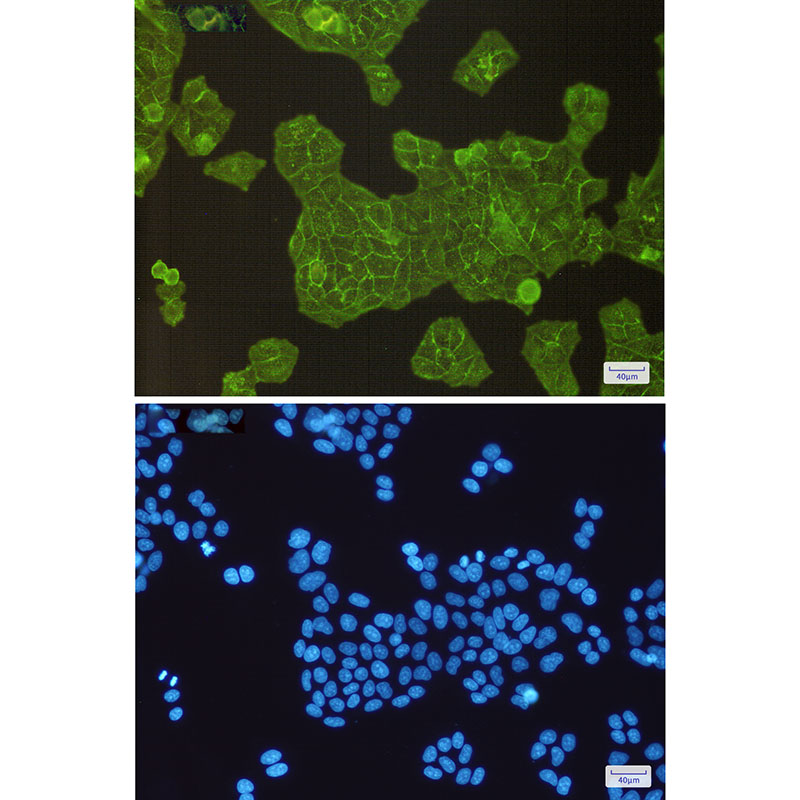 alpha Actinin 4 Rabbit mAb