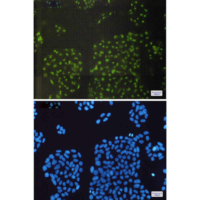 alpha B Crystallin Rabbit mAb