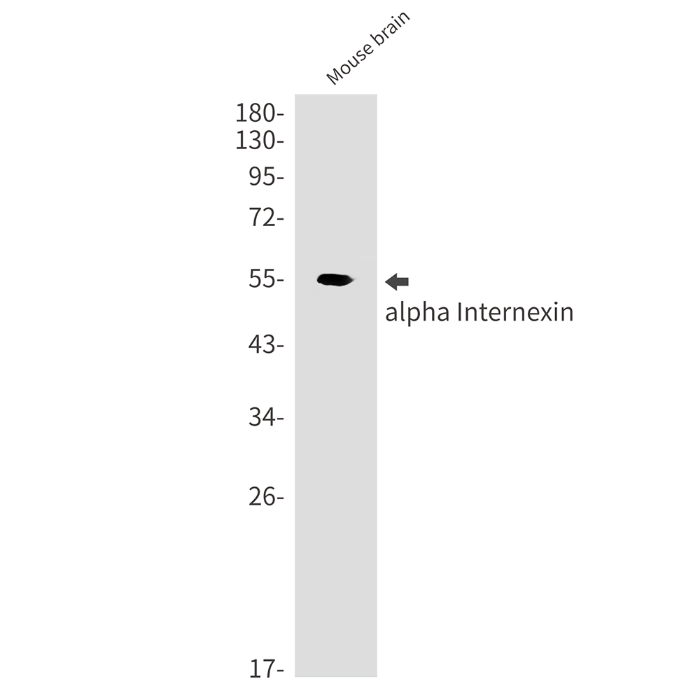 alpha Internexin Rabbit mAb