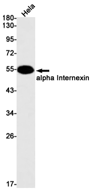 alpha Internexin Rabbit mAb