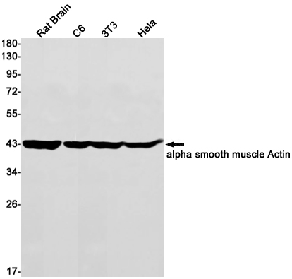 alpha Smooth Muscle Actin Rabbit mAb