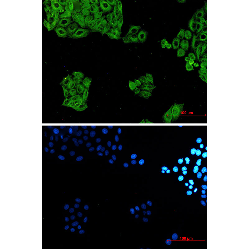 alpha Tubulin Rabbit mAb