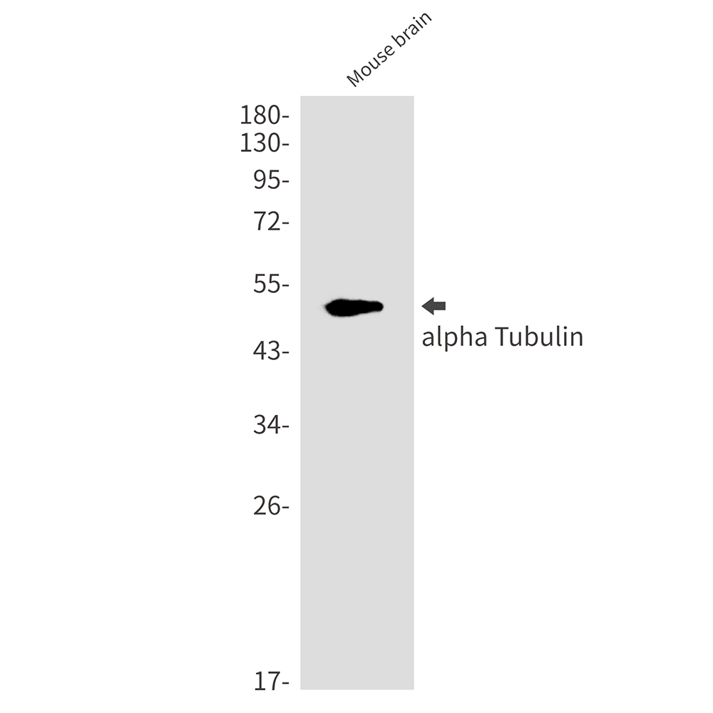 alpha Tubulin Rabbit mAb