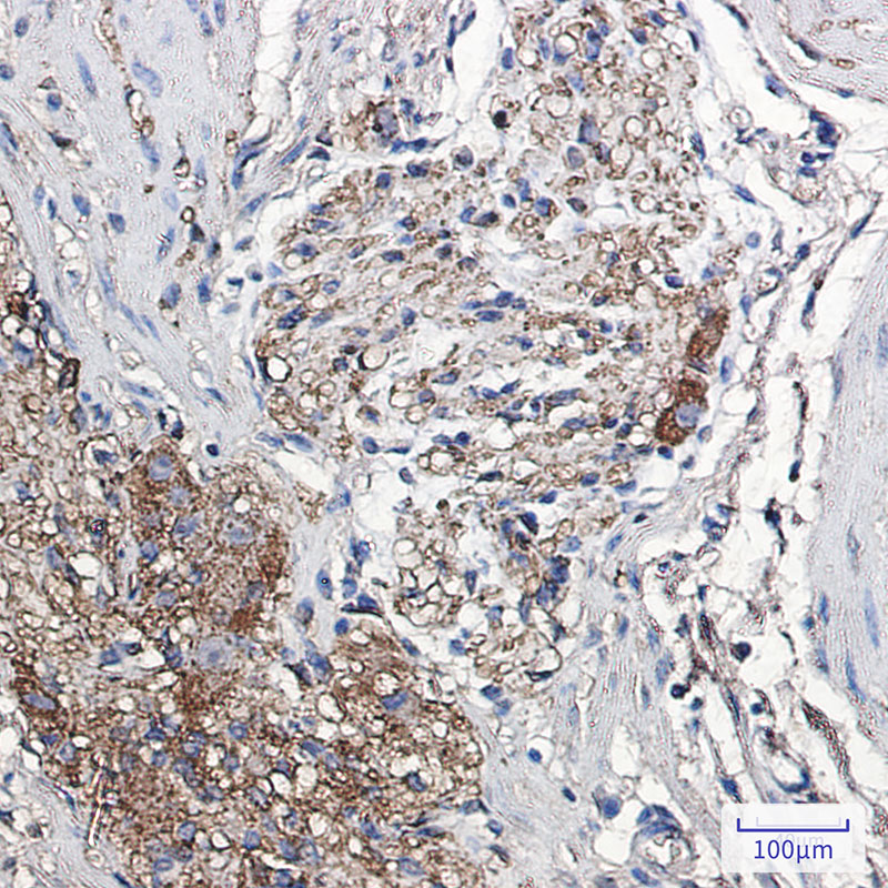 alpha Synuclein Rabbit mAb