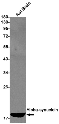 alpha Synuclein Rabbit mAb